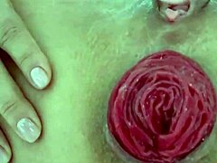 Destroyed Anal Prolapse in Extreme Close-Up Play
