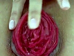 Destroyed Anal Prolapse in Extreme Close-Up Play