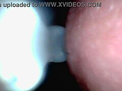Wanna see male ejaculation caught on endoscope camera?