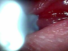 Wanna see male ejaculation caught on endoscope camera?